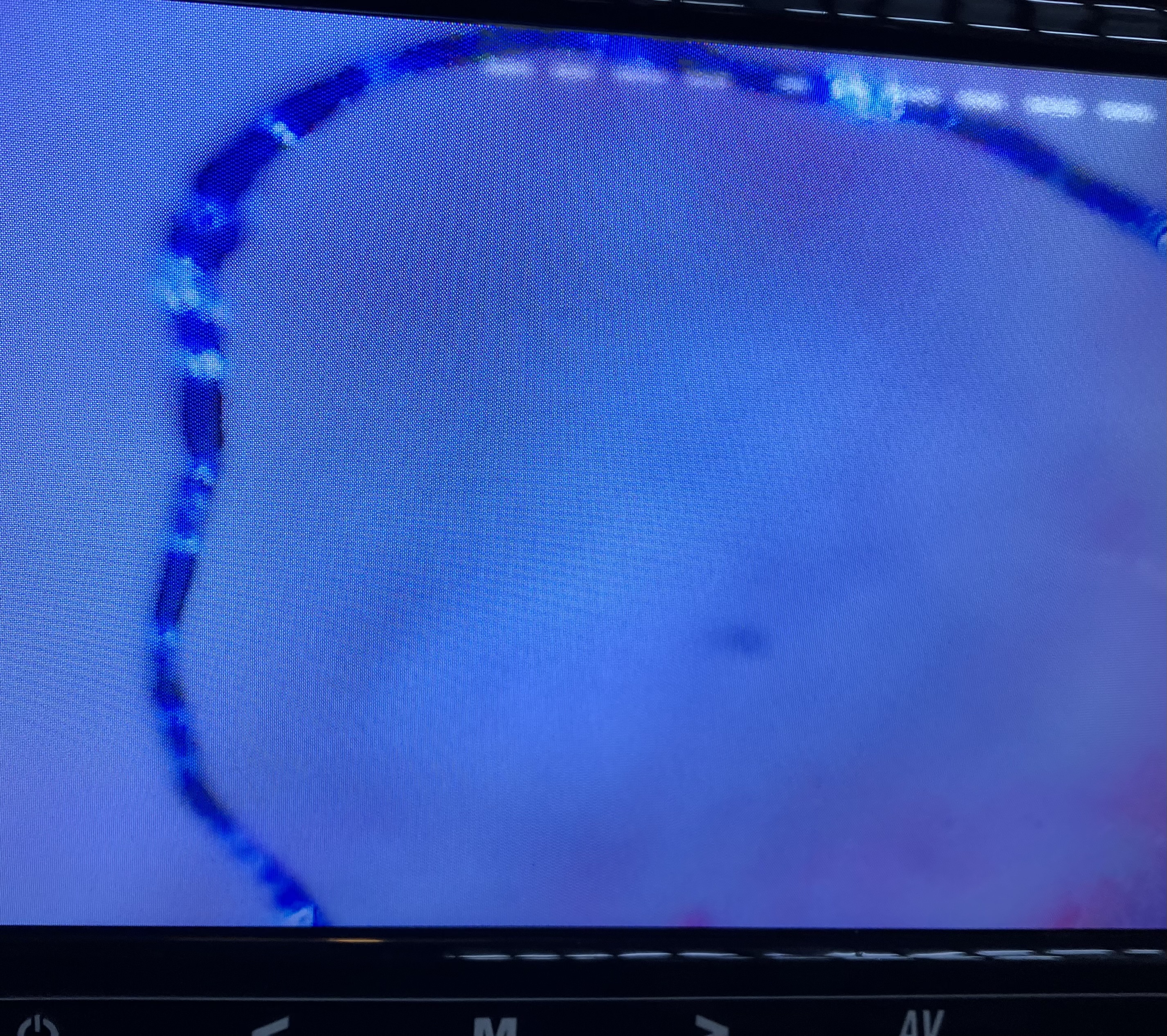 ワクチンによる体内重金属とは❓の写真